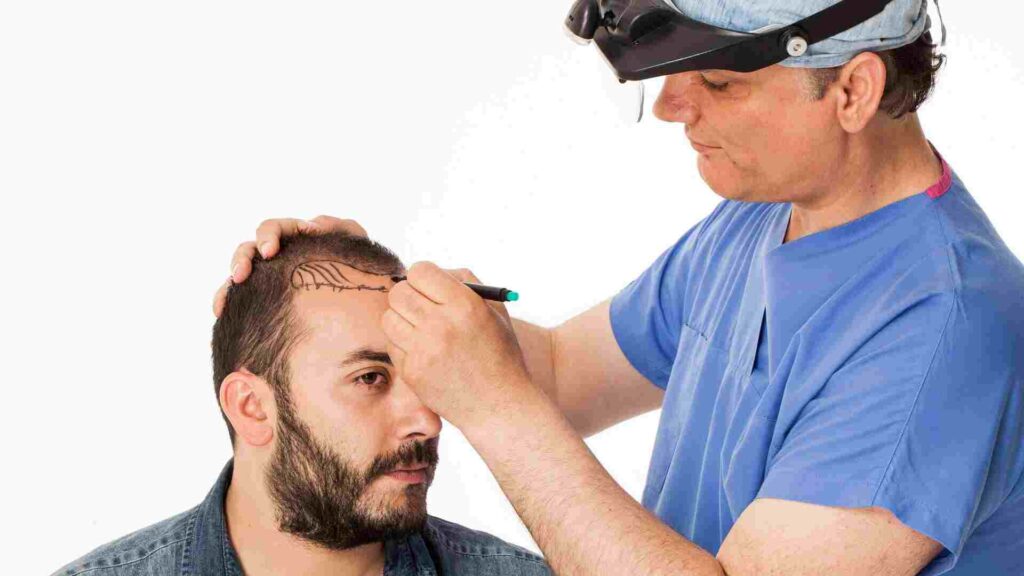 Natural and Permanent Hair Transplant Solutions at Live Hair Clinic