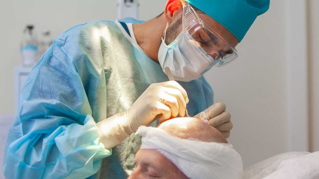 10 Years Later: What Does a Hair Transplant Actually Look Like a Decade Down the Road?