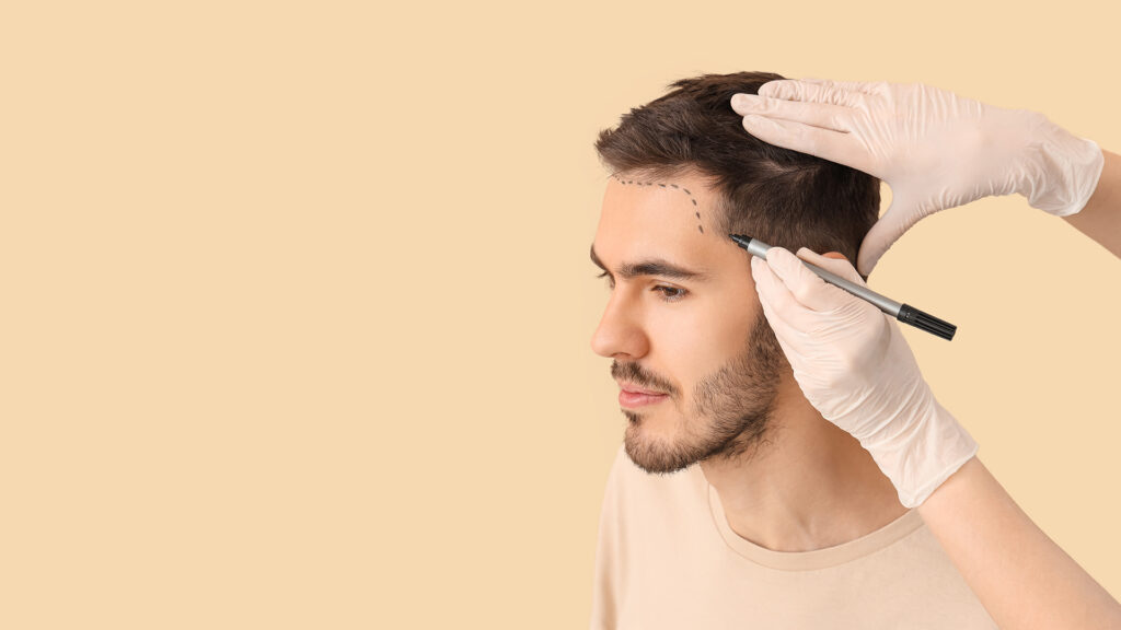 Bio-Hacking Your Recovery: Supplements and Habits for Faster Hair Growth Post-Surgery