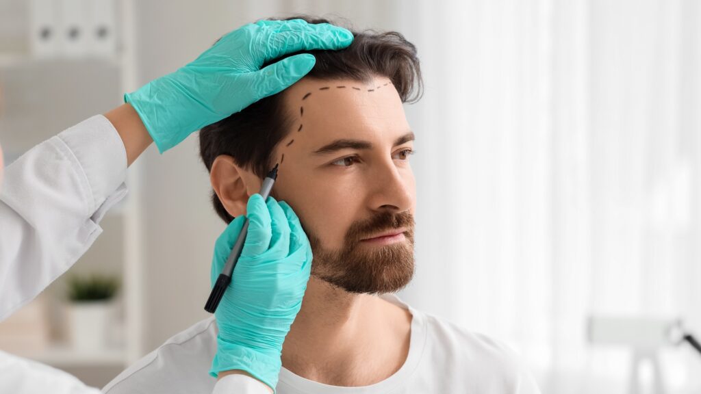 FUE vs. DHI: Which Hair Transplant Technique is Right for You?